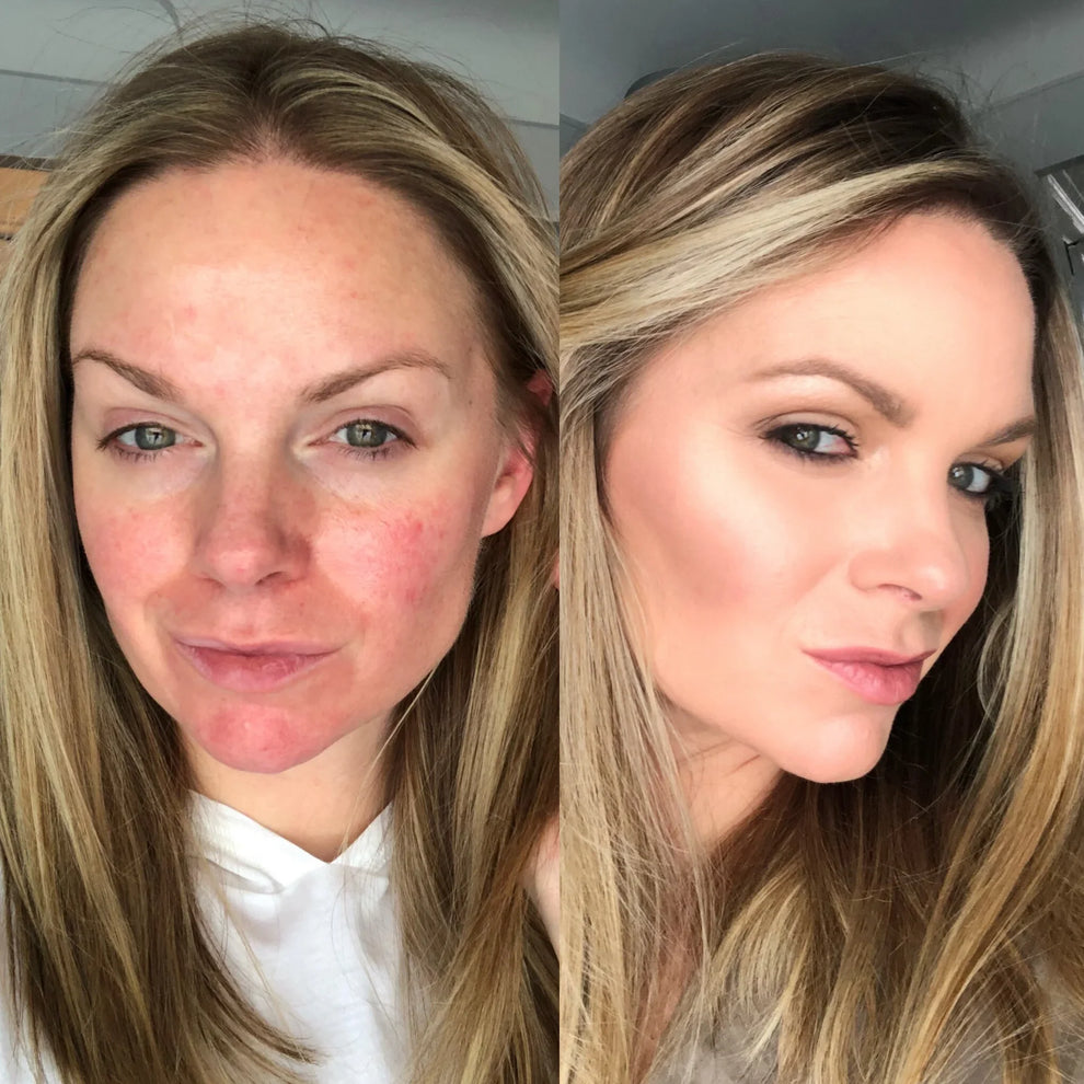 FlawFusion™ | Base 4-en-1 Espectral | Elimina 8 productos en 5 minutos diarios!